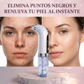 Extractor de espinillas y puntos negros a vapor
