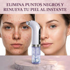 Extractor de espinillas y puntos negros a vapor