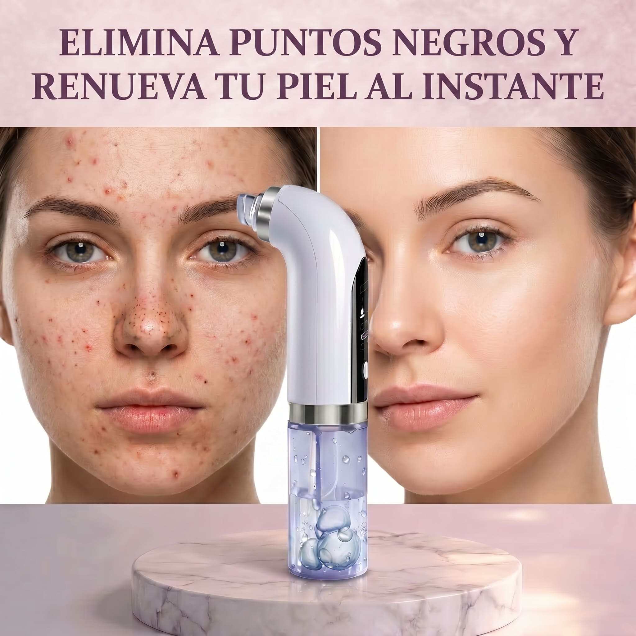 Extractor de espinillas y puntos negros a vapor