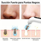 Extractor de espinillas y puntos negros a vapor