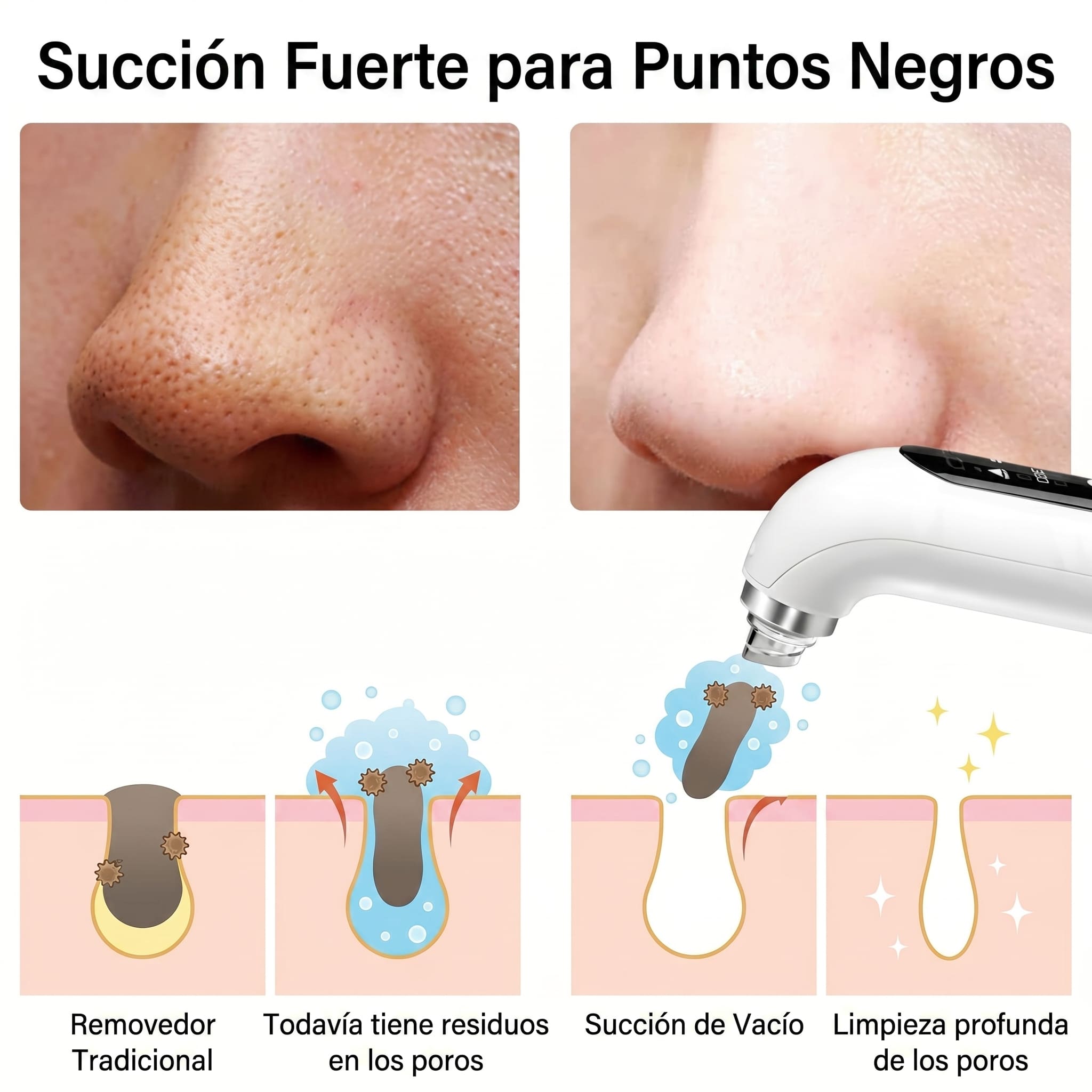 Extractor de espinillas y puntos negros a vapor